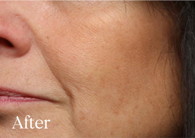 After image: a woman with a smoother complexion