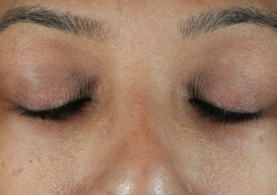 After image: a woman with a smoother complexion